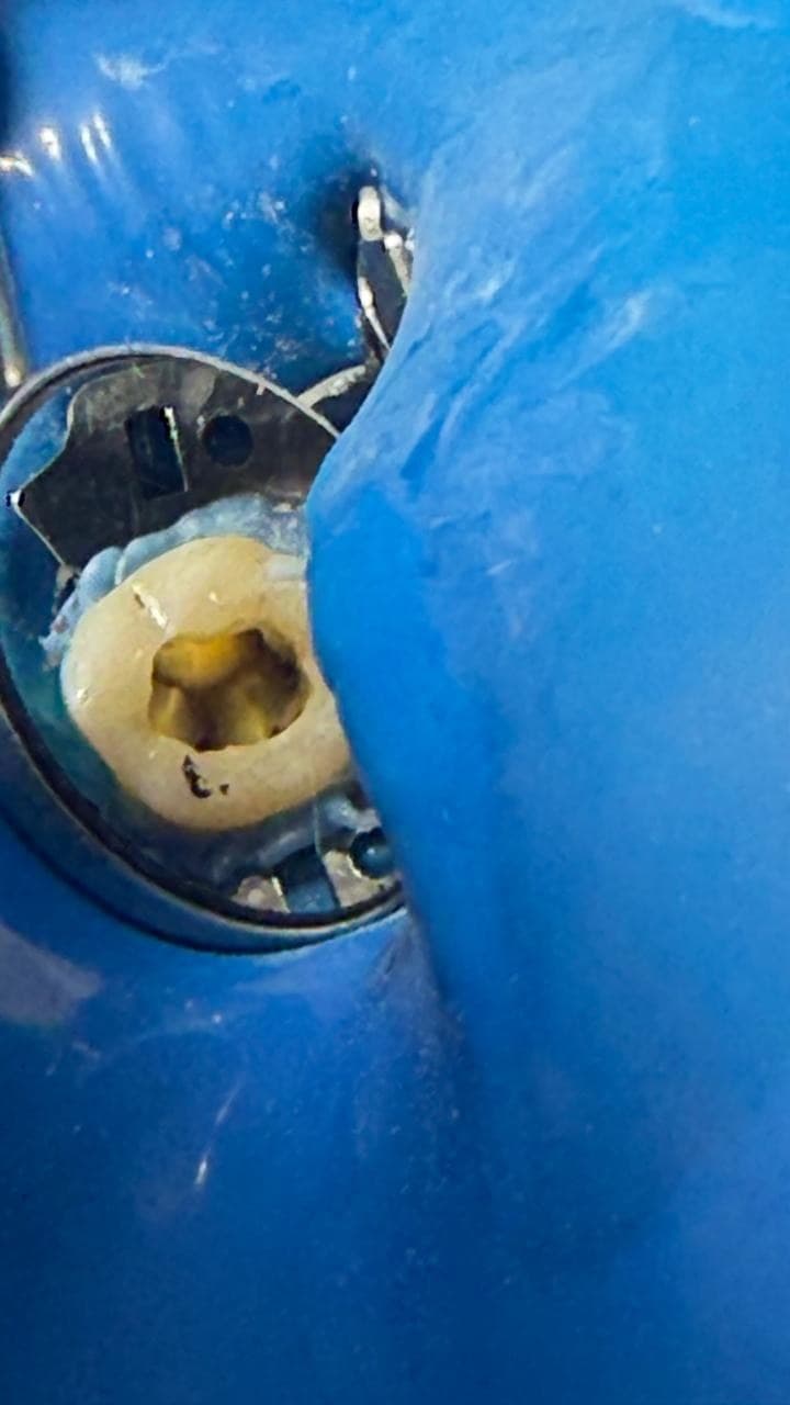 Detalhe da cavidade de acesso do dente durante atendimento endodôntico